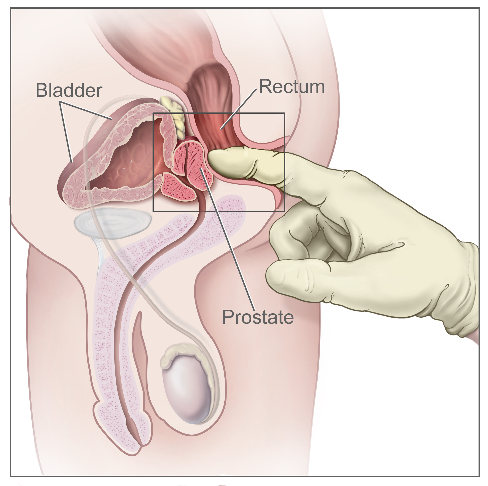 How to use a Prostate Massager Diagram